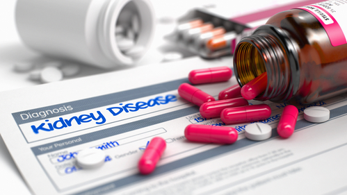 The link between PPIs and kidney disease grows