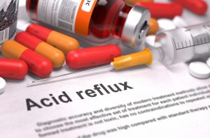 acid reflux drugs